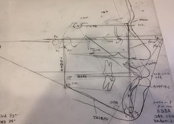 セファログラム分析