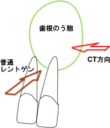 CT 3D画像